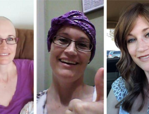 How to Choose a Wig Before Chemotherapy